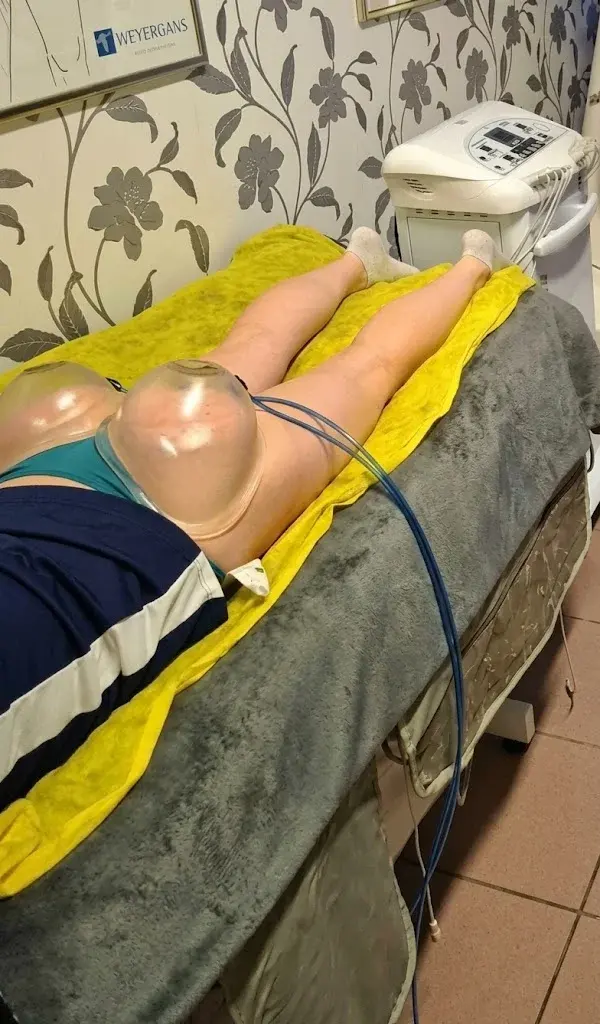 SPM vákuummasszázs cellulitkezelés közben